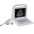 MT Medical China Digital Portable Veterinary Ultrasound Price